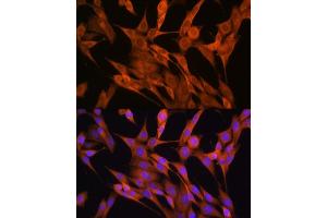 Immunofluorescence (IF) image for anti-S100 Calcium Binding Protein A14 (S100A14) (AA 1-104) antibody (ABIN6147339)