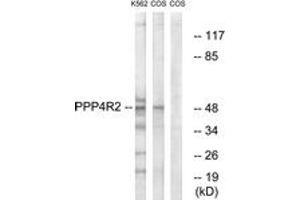 Western Blotting (WB) image for anti-Protein Phosphatase 4, Regulatory Subunit 2 (PPP4R2) (AA 171-220) antibody (ABIN2890625) (PPP4R2 抗体  (AA 171-220))