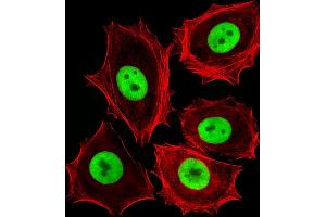 Fluorescent image of MCF-7 cells stained with (Rat) Cdk4 Antibody (C-term) B. (CDK4 抗体  (C-Term))