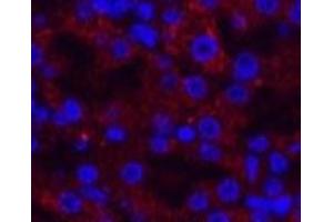 Immunofluorescence analysis of Mouse kidney tissue using AMACR Monoclonal Antibody at dilution of 1:200. (AMACR 抗体)