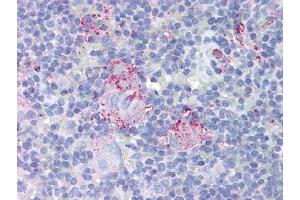 Image no. 1 for anti-Mdm2, p53 E3 Ubiquitin Protein Ligase Homolog (Mouse) (MDM2) antibody (ABIN302837) (MDM2 抗体)