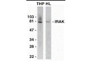 Western Blotting (WB) image for anti-Interleukin-1 Receptor-Associated Kinase 1 (IRAK1) (C-Term) antibody (ABIN2475130) (IRAK1 抗体  (C-Term))