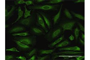 Immunofluorescence (IF) image for anti-Asparaginyl-tRNA Synthetase (NARS) (AA 1-548) antibody (ABIN950022)