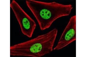 Immunofluorescence (IF) image for anti-Sp1 Transcription Factor (SP1) antibody (ABIN3032703)