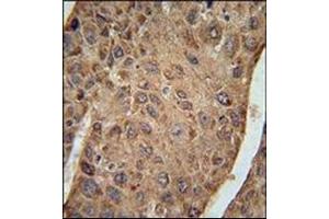 Immunohistochemistry (Paraffin-embedded Sections) (IHC (p)) image for anti-Ribosomal Protein L27a (RPL27A) (AA 113-142), (C-Term) antibody (ABIN954592)
