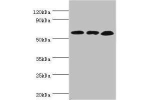 Western blot All lanes: Glutamate dehydrogenase 2, mitochondrial antibody at 4 μg/mL Lane 1: Mouse brain tissue Lane 2: 293T whole cell lysate Lane 3: Rat brain tissue Secondary Goat polyclonal to rabbit IgG at 1/10000 dilution Predicted band size: 61 kDa Observed band size: 61 kDa (GLUD2 抗体  (AA 319-558))