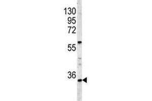 Western blot analysis of HOXA9 antibody and A2058 lysate. (HOXA9 抗体  (AA 245-272))
