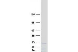 Western Blotting (WB) image for Ribosomal Protein L35 (RPL35) protein (Myc-DYKDDDDK Tag) (ABIN2731143)