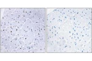 Immunohistochemistry (IHC) image for anti-Tumor Protein P53 Binding Protein 1 (TP53BP1) (AA 1-50), (pSer6) antibody (ABIN1531478)