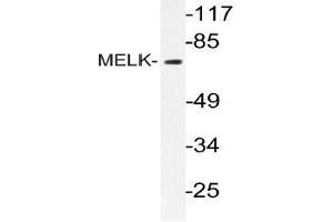 Western blot (WB) analysis of MELK antibody in extracts from k562 cells. (MELK 抗体)
