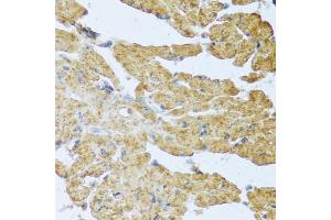 Immunohistochemistry (IHC) image for anti-Interleukin 20 (IL20) (AA 25-176) antibody (ABIN6142353)