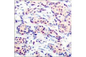 Image no. 2 for anti-Jun D Proto-Oncogene (JUND) (Ser255) antibody (ABIN197142) (JunD 抗体  (Ser255))