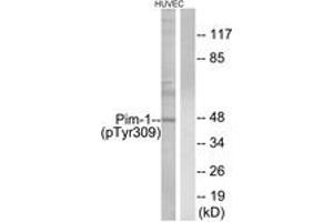 Western blot analysis of extracts from HuvEc cells treated with PMA 125ng/ml 30', using Pim-1 (Phospho-Tyr309) Antibody. (PIM1 抗体  (pTyr309))
