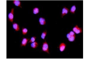 IF analysis of IRF3 using anti-IRF3 antibody (ABIN7599373).