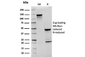 SDS-PAGE Analysis Purified CD27 Recombinant Mouse Monoclonal Antibody (rLPFS2/1611). (Recombinant CD27 抗体)