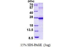 SDS-PAGE (SDS) image for Ephrin A3 (EFNA3) (AA 23-214) protein (His tag) (ABIN5852970) (Ephrin A3 Protein (EFNA3) (AA 23-214) (His tag))