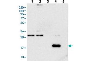 Western blot analysis of Lane 1: RT-4, Lane 2: U-251 MG, Lane 3: Human Plasma, Lane 4: Liver, Lane 5: Tonsil with RWDD4A polyclonal antibody . (RWDD4A 抗体)