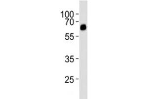 Western blot analysis of lysate from rat uterus tissue lysate using ALK3 antibody diluted at 1:1000. (BMPR1A 抗体  (AA 30-60))