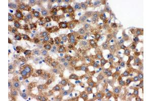 Immunohistochemistry (Paraffin-embedded Sections) (IHC (p)) image for anti-Transferrin (TF) (AA 20-49), (N-Term) antibody (ABIN3043419) (Transferrin 抗体  (N-Term))