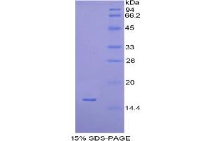 SDS-PAGE analysis of Human H2AFJ Protein. (H2AFJ 蛋白)