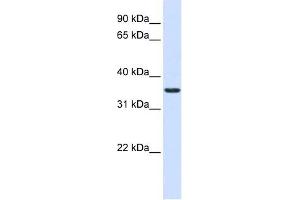 TXNDC14 antibody used at 1 ug/ml to detect target protein. (TMX2 抗体  (Middle Region))