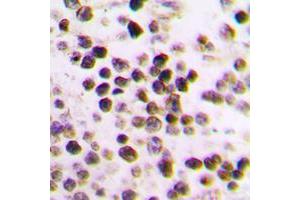 Immunohistochemical analysis of Cullin 3 staining in human tonsil formalin fixed paraffin embedded tissue section. (Cullin 3 抗体  (N-Term))