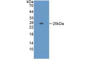 Western blot analysis of recombinant Mouse ADAMTS7. (ADAMTS7 抗体  (AA 226-437))