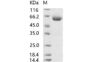 Western Blotting (WB) image for SARS-Coronavirus Spike Protein (SARS-CoV S) (RBD) protein (mFc Tag) (ABIN7197789) (SARS-CoV Spike Protein (RBD) (mFc Tag))