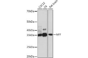 Western blot analysis of extracts of various cell lines, using MFF Rabbit mAb (ABIN7268550) at 1:500 dilution. (MFF 抗体)