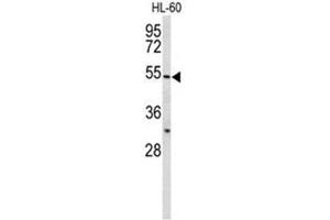 Western blot analysis of BPI Antibody (Center) in HL-60 cell line lysates (35µg/lane). (BPI 抗体  (Middle Region))