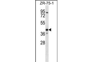 KCNK1 Antibody (C-term) (ABIN656655 and ABIN2845896) western blot analysis in ZR-75-1 cell line lysates (35 μg/lane). (KCNK1 抗体  (C-Term))