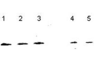 Western blot analysis of NUDT1 in NT2 cells (Lanes 1-3), and 833K64Cp9 cells (Lanes 4-5) with NUDT1 polyclonal antibody . (NUDT1 抗体  (C-Term))