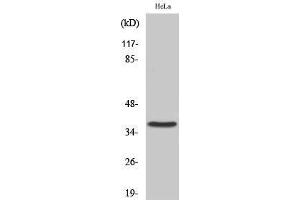 Western Blotting (WB) image for anti-Cysteinyl Leukotriene Receptor 2 (CYSLTR2) (C-Term) antibody (ABIN3184211) (CasLTR2 抗体  (C-Term))