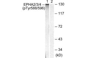 Western blot analysis of extracts from HepG2 cells, using EPHA2/3/4 (Phospho-Tyr588/596) antibody. (EPHA2/3 抗体  (pTyr588, pTyr596))