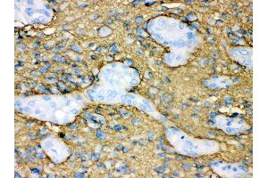 Anti- Aquaporin 4 Picoband antibody, IHC(P) IHC(P): Human Glioma Tissue (Aquaporin 4 抗体  (C-Term))