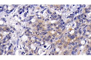 Immunohistochemistry (IHC) image for anti-V-Akt Murine Thymoma Viral Oncogene Homolog 1 (AKT1) (AA 122-443) antibody (ABIN7439390)