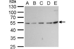 WB Image beta Tubulin 2 antibody detects beta Tubulin 2 protein by western blot analysis. (TUBB2A 抗体)