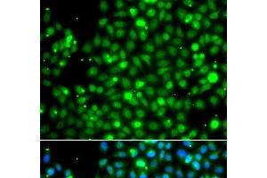 Immunofluorescence analysis of A549 cells using NME2 Polyclonal Antibody (NME2 抗体)