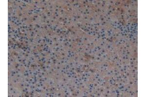 IHC-P analysis of Rat Adrenal Gland Tissue, with DAB staining. (TXNRD1 抗体  (AA 208-433))