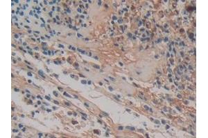 Immunohistochemistry (IHC) image for anti-Haptoglobin (HP) (AA 44-157) antibody (ABIN7429061)