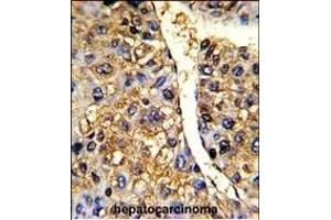 Immunohistochemistry (Paraffin-embedded Sections) (IHC (p)) image for anti-Tu Translation Elongation Factor, Mitochondrial (Tufm) (AA 75-104), (N-Term) antibody (ABIN389459)