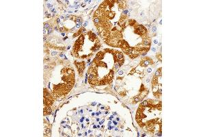 Immunohistochemical analysis of paraffin-embedded H. (LIMK2 抗体  (C-Term))