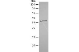 CTAG1B Protein (AA 1-146) (His-IF2DI Tag)