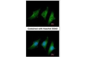 ICC/IF Image Immunofluorescence analysis of methanol-fixed HeLa, using CD55, antibody at 1:200 dilution. (CD55 抗体  (Center))