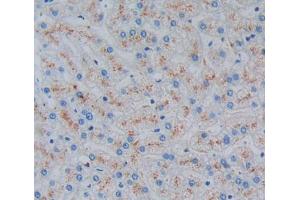 Used in DAB staining on fromalin fixed paraffin- embedded liver tissue (Ladinin 1 抗体  (AA 1-192))