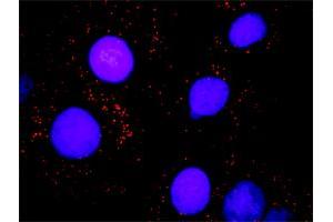 Proximity Ligation Assay (PLA) image for anti-SWI/SNF Related, Matrix Associated, Actin Dependent Regulator of Chromatin, Subfamily B, Member 1 (SMARCB1) (AA 1-385) antibody (ABIN520283)