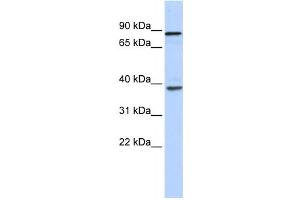 Western Blotting (WB) image for anti-DEAH (Asp-Glu-Ala-His) Box Polypeptide 35 (DHX35) antibody (ABIN2458247)