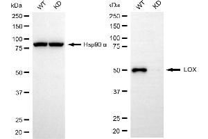 Western blotting analysis using LOX antibody (ABIN7799311). (Recombinant LOX 抗体)