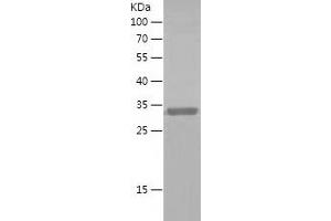 Western Blotting (WB) image for Friend Leukemia Virus Integration 1 (FLI1) (AA 185-452) protein (His tag) (ABIN7123005)