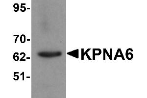 Western blot analysis of KPNA6 in 293 cell lysate with KPNA6 antibody at 1 µg/mL. (KPNA6 抗体  (N-Term))